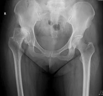 Paediatric radiograph for self-assessment