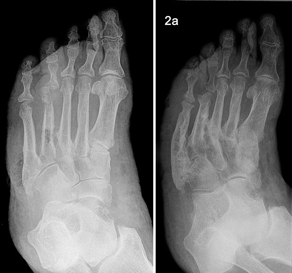 Bone & joint disease radiograph for self-assessment