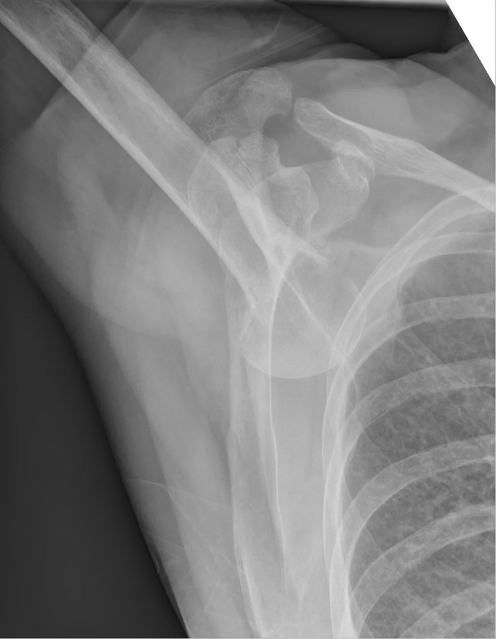Upper limb radiograph for self-assessment