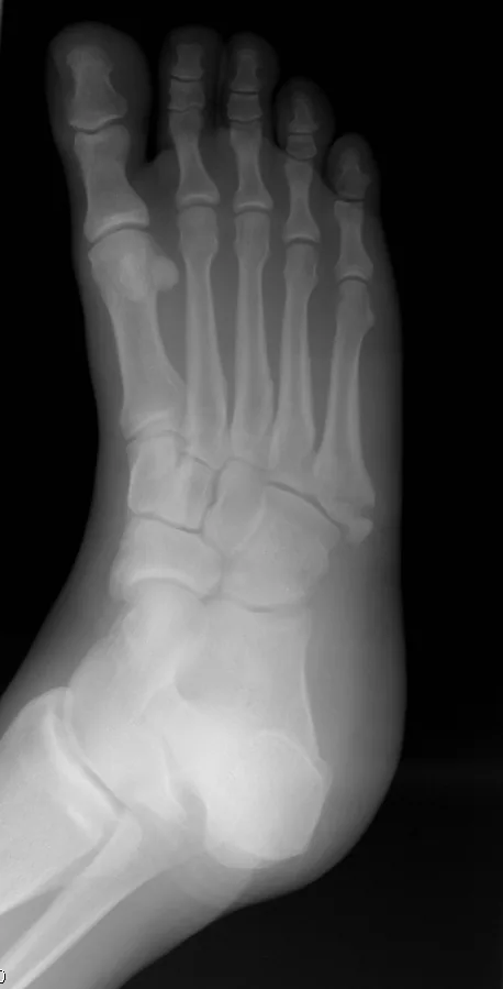 Lower limb radiograph for self-assessment