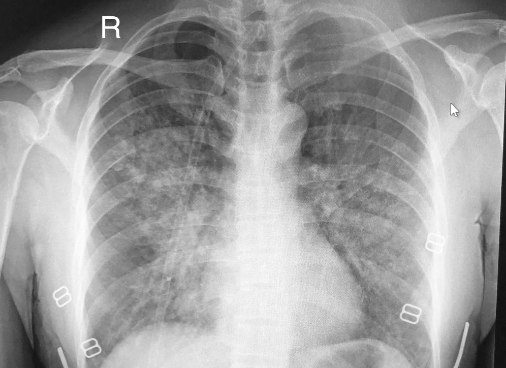 Chest radiograph for self-assessment