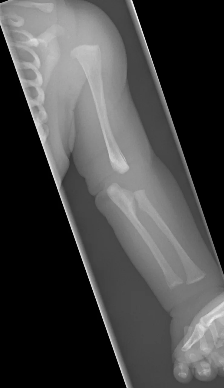Paediatric radiograph for self-assessment