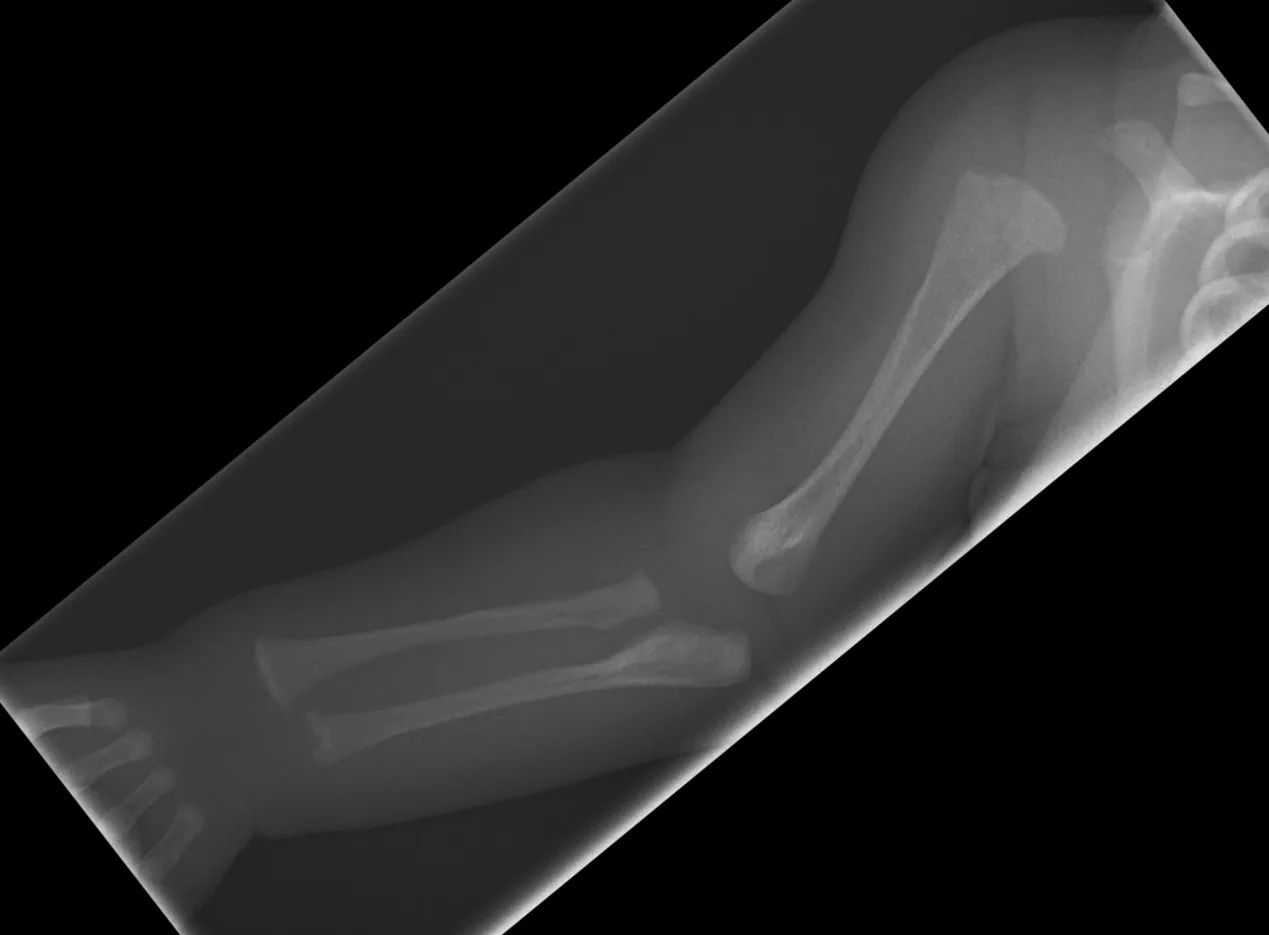 Paediatric radiograph for self-assessment