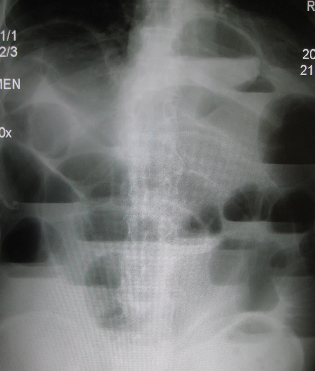 Abdomen radiograph for self-assessment