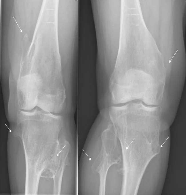 Bone & joint disease radiograph for self-assessment