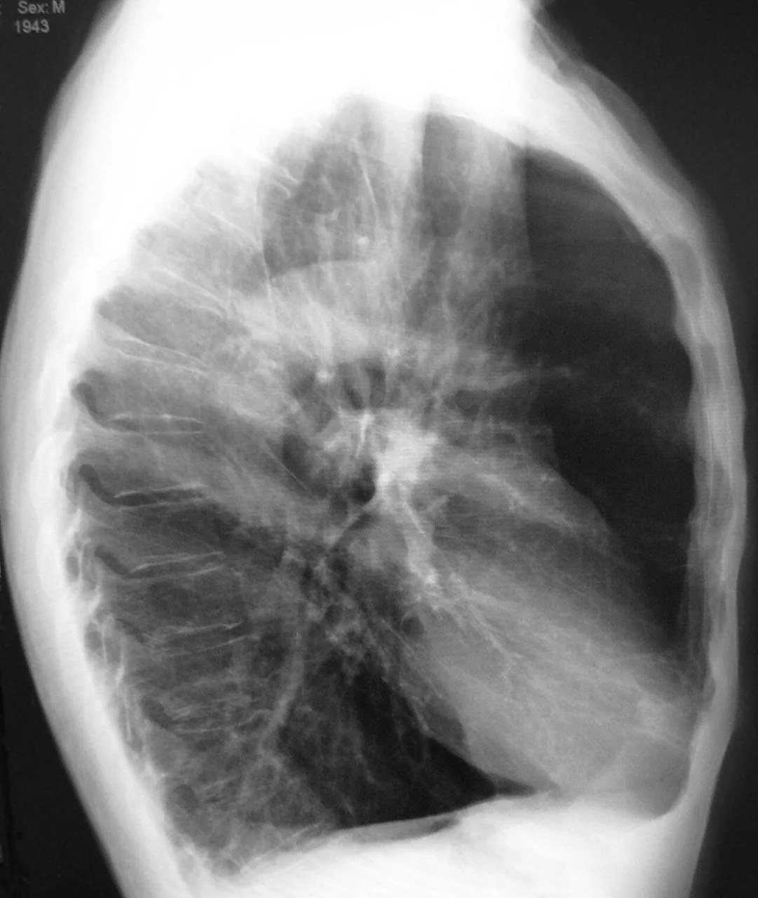 Chest radiograph for self-assessment