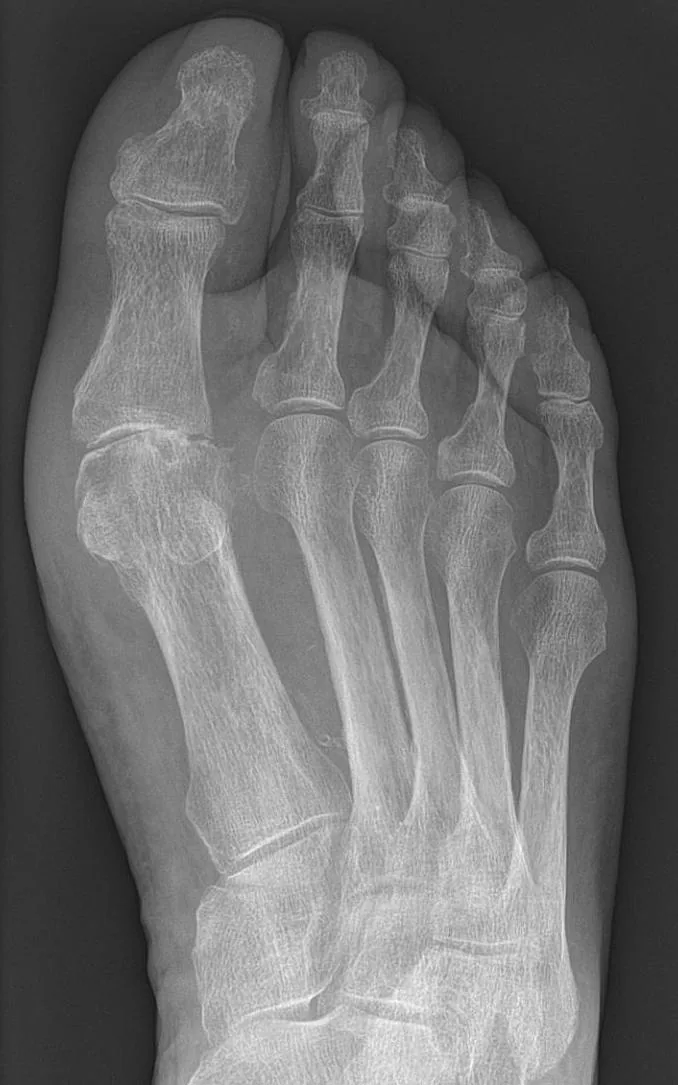 Bone & joint disease radiograph for self-assessment
