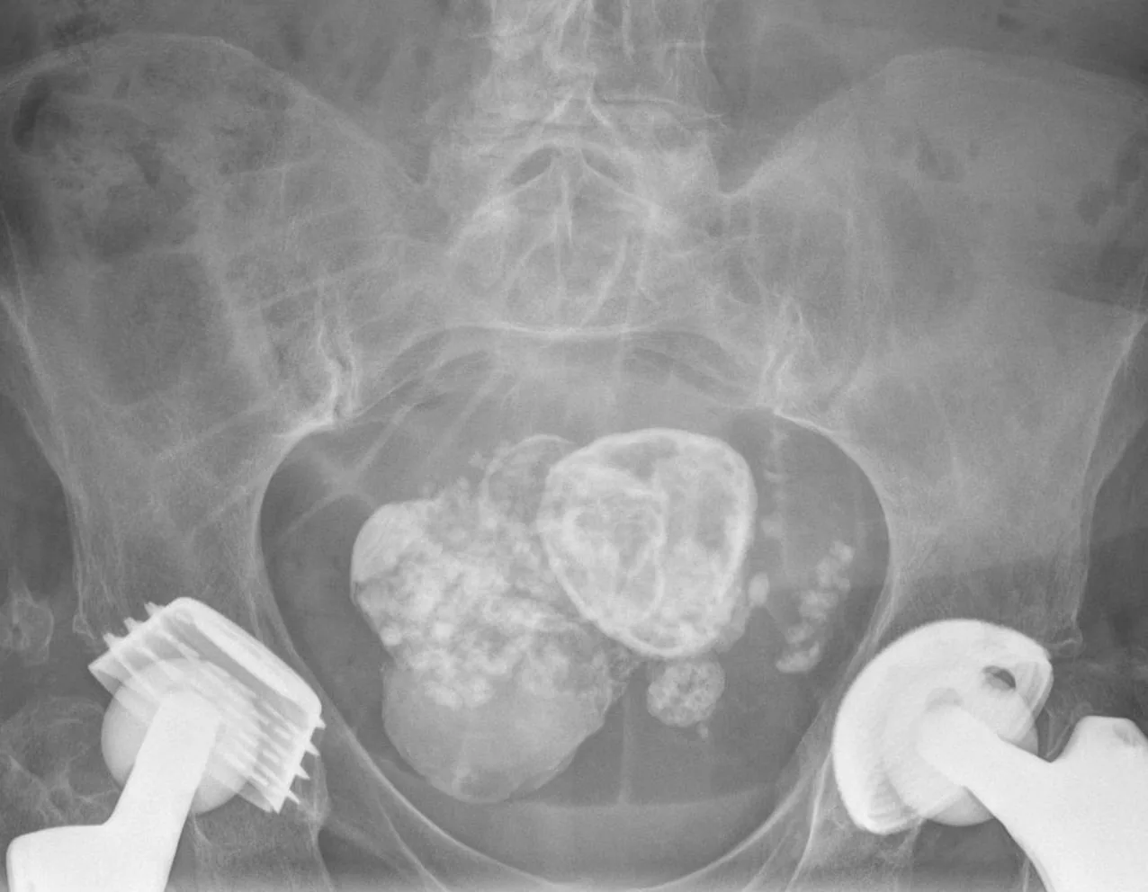 Abdomen radiograph for self-assessment
