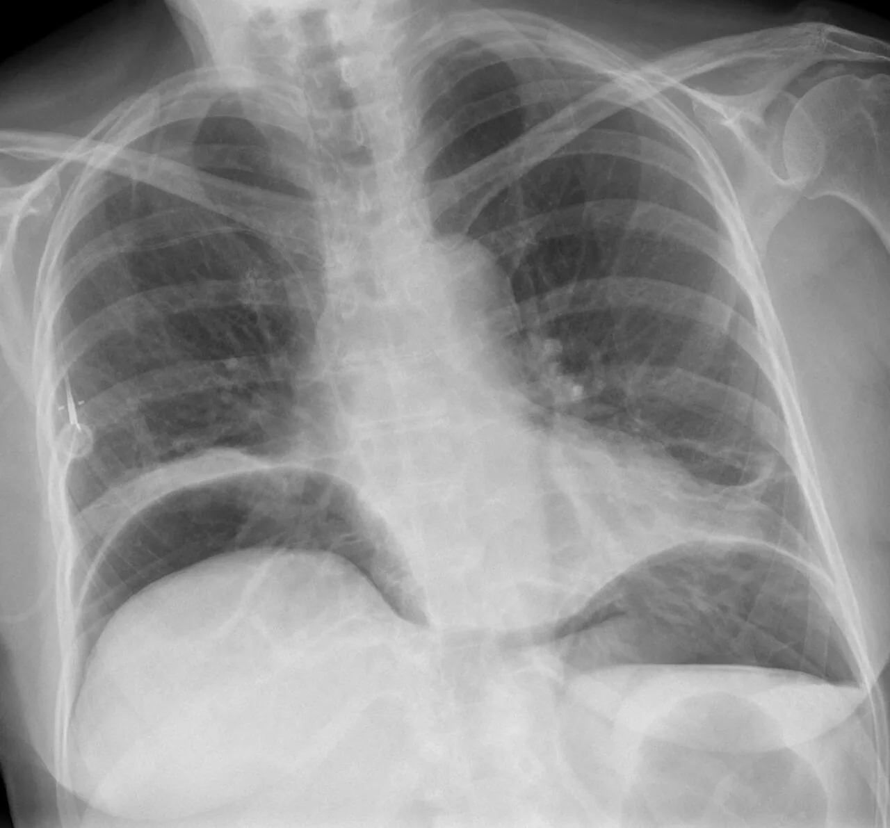 Abdomen radiograph for self-assessment
