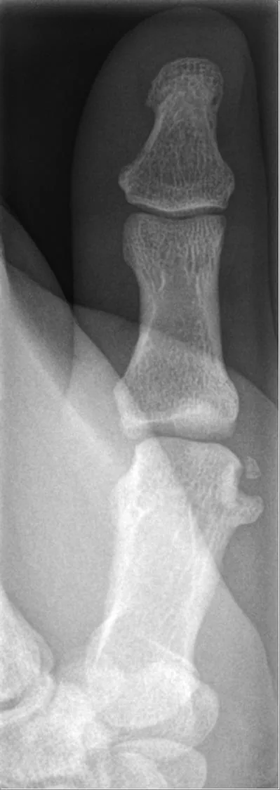 Bone & joint disease radiograph for self-assessment