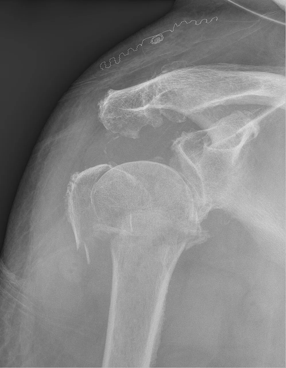 Upper limb radiograph for self-assessment