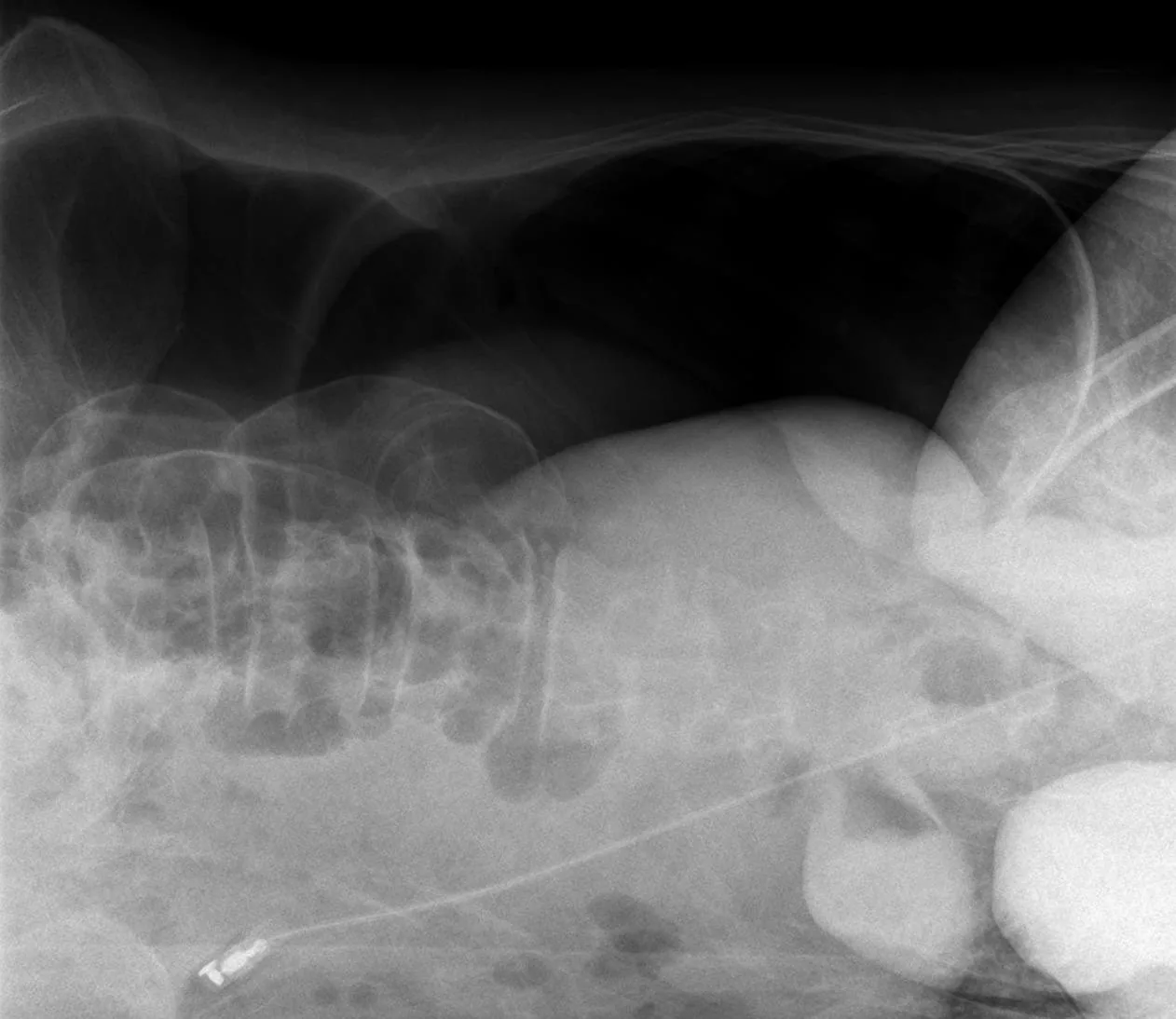 Abdomen radiograph for self-assessment