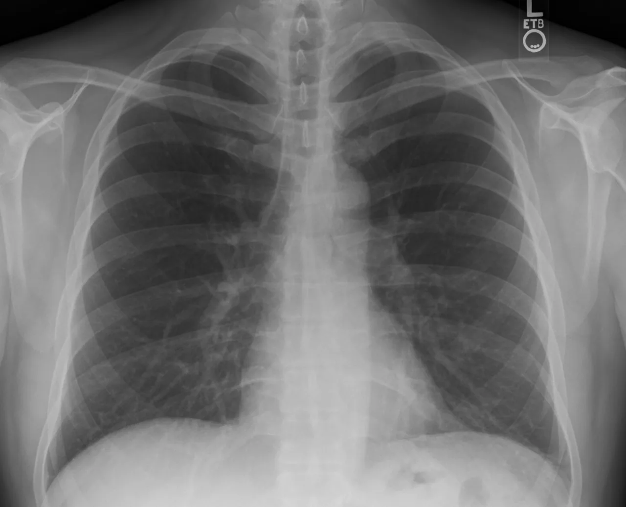 Chest radiograph for self-assessment