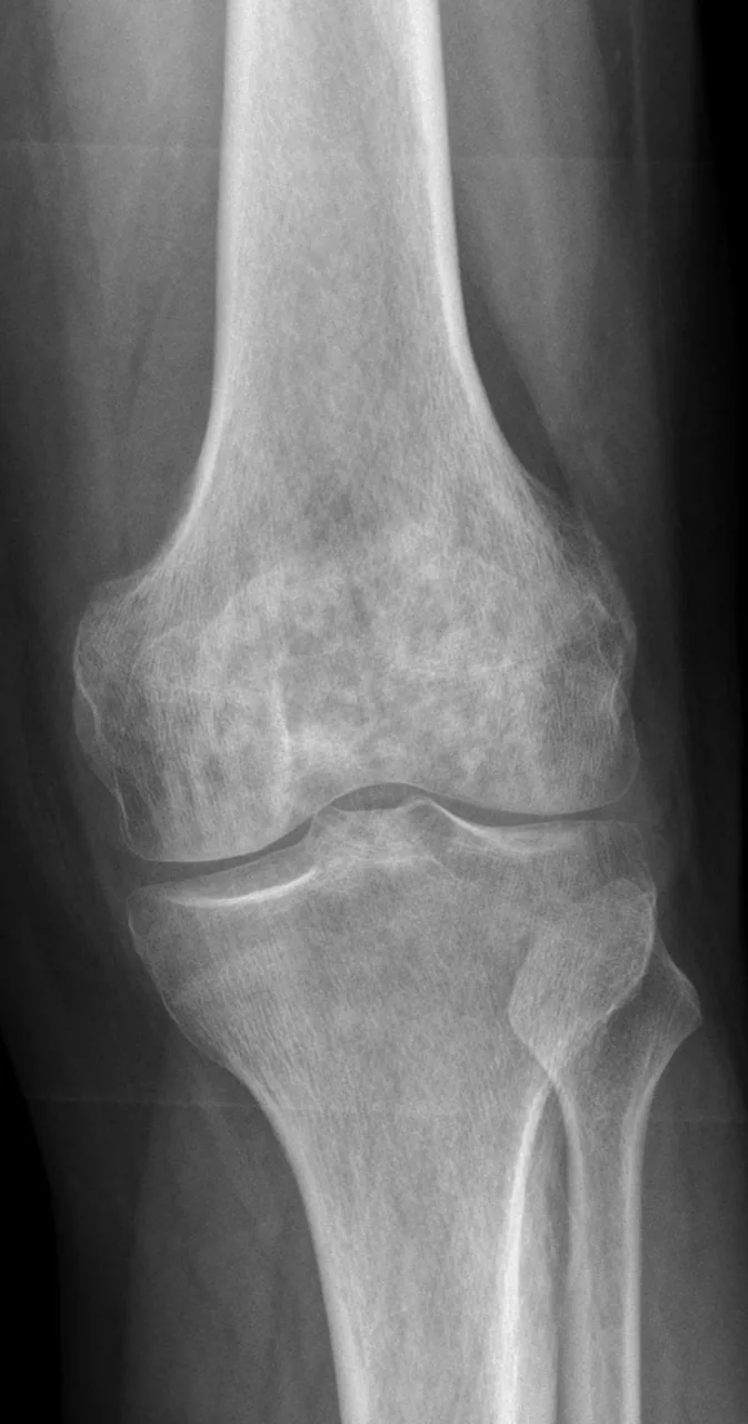 Bone & joint disease radiograph for self-assessment