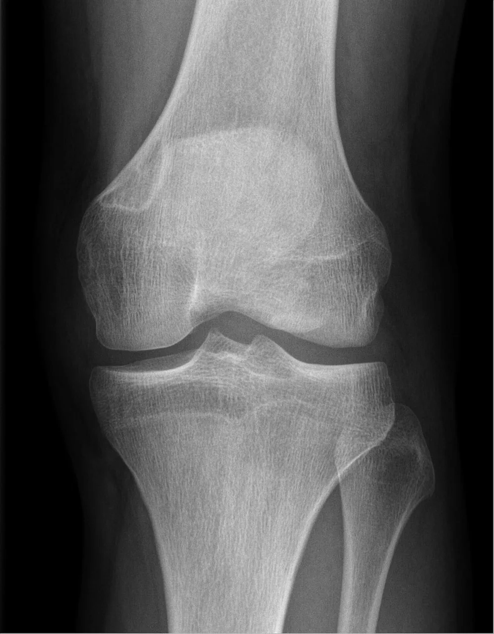 Bone & joint disease radiograph for self-assessment
