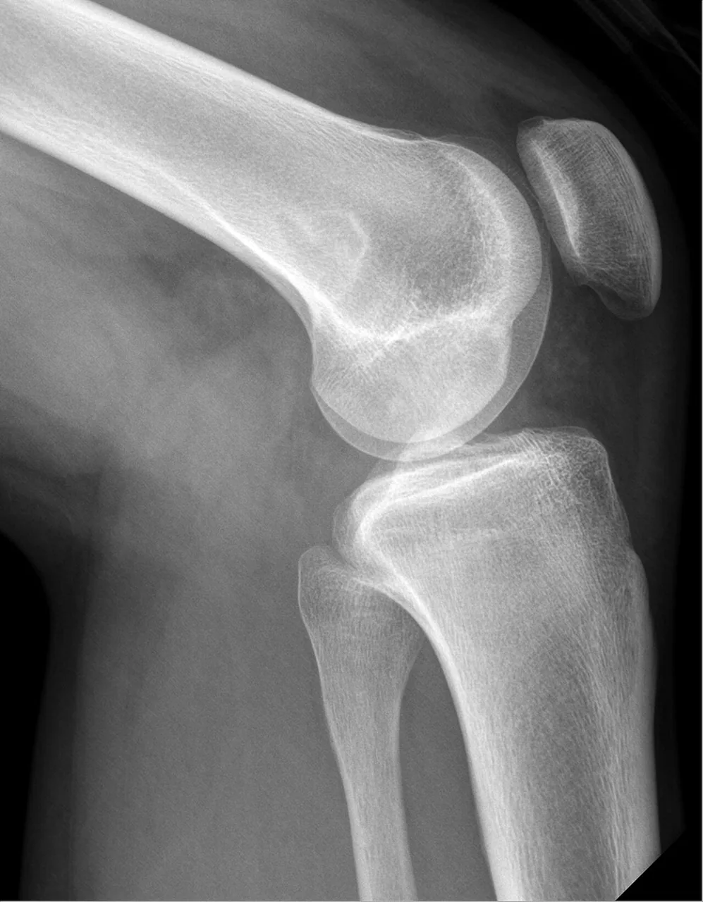 Bone & joint disease radiograph for self-assessment