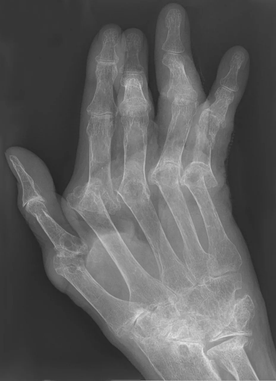 Bone & joint disease radiograph for self-assessment