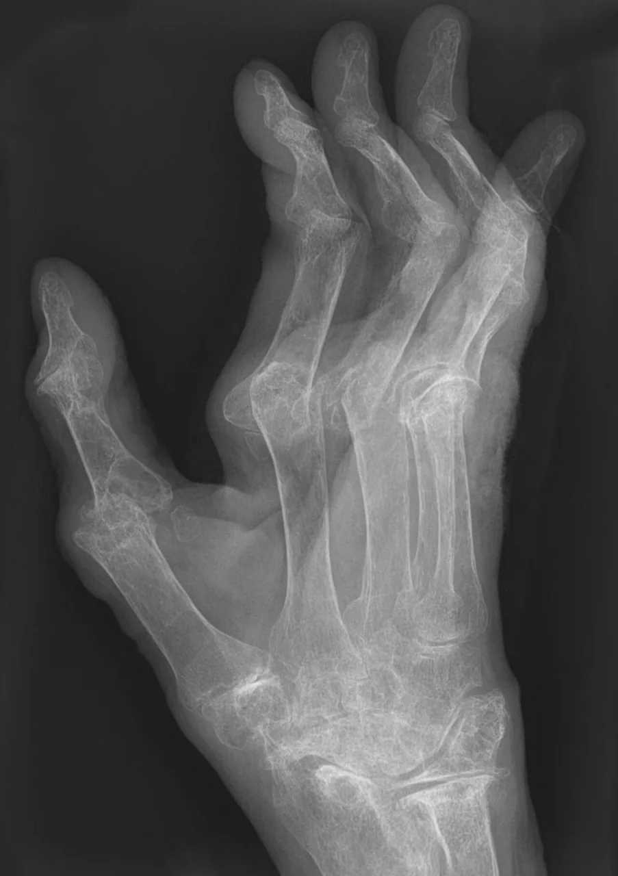 Bone & joint disease radiograph for self-assessment