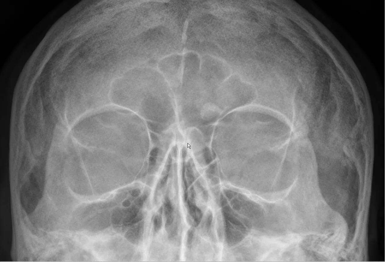 Bone & joint disease radiograph for self-assessment
