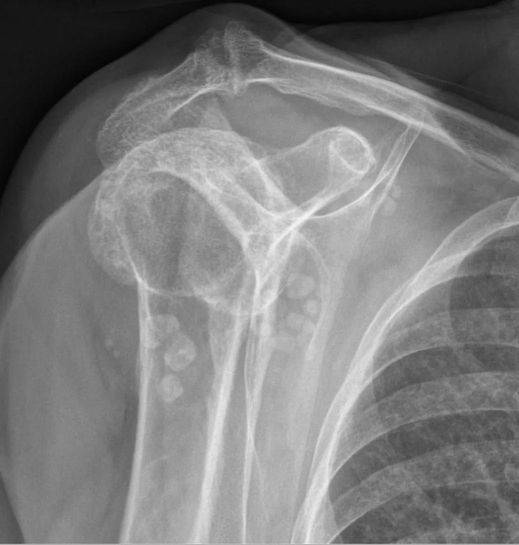 Bone & joint disease radiograph for self-assessment
