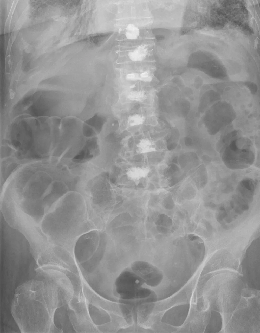 Abdomen radiograph for self-assessment