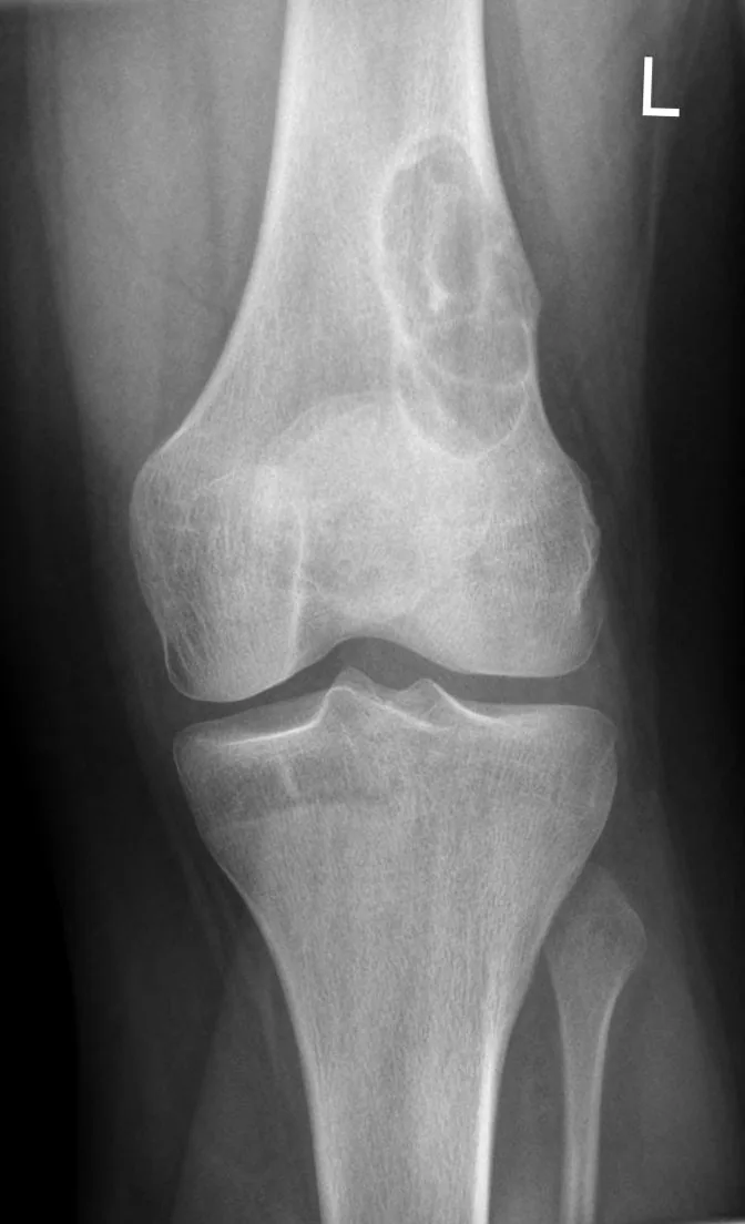 Bone & joint disease radiograph for self-assessment