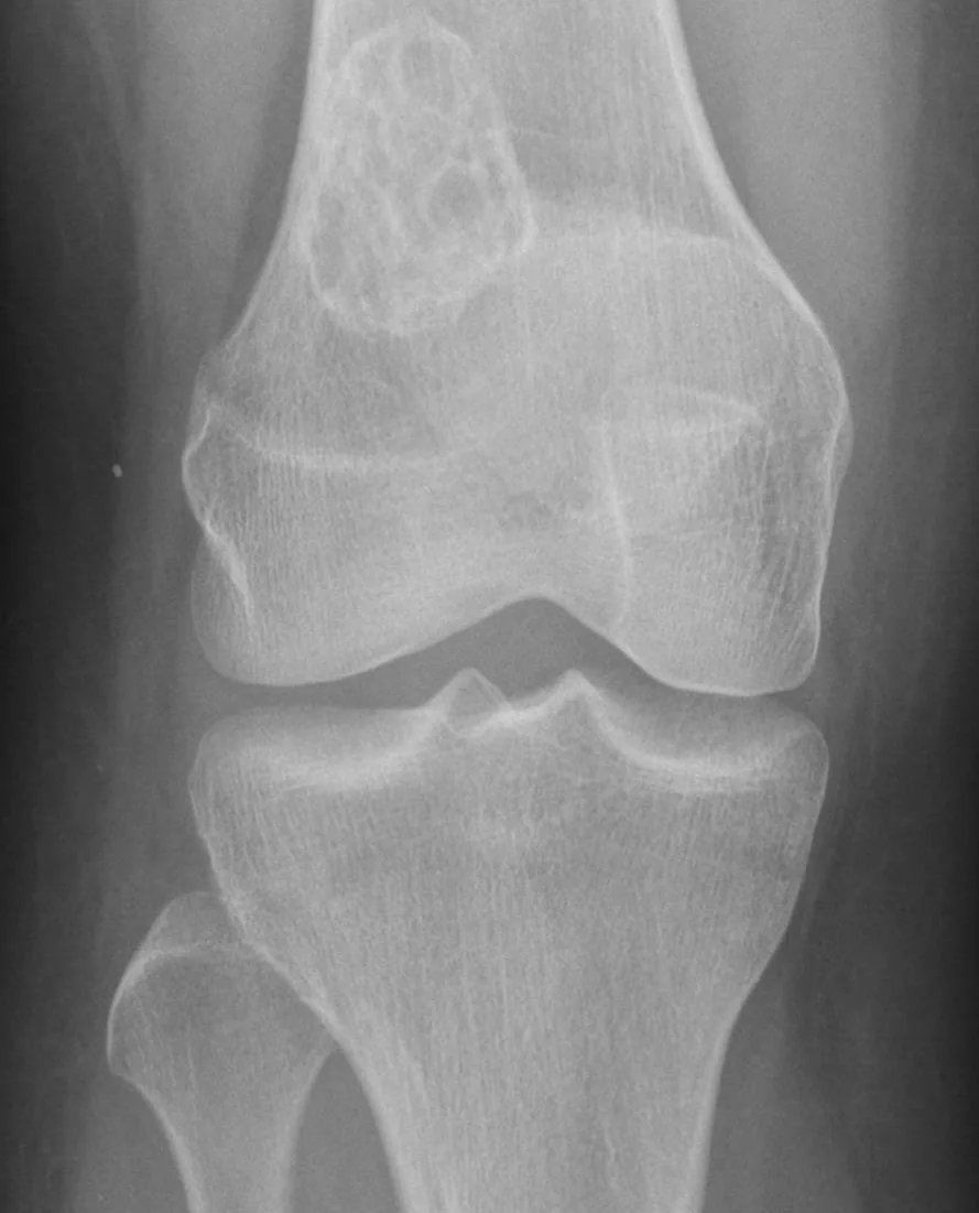 Bone & joint disease radiograph for self-assessment