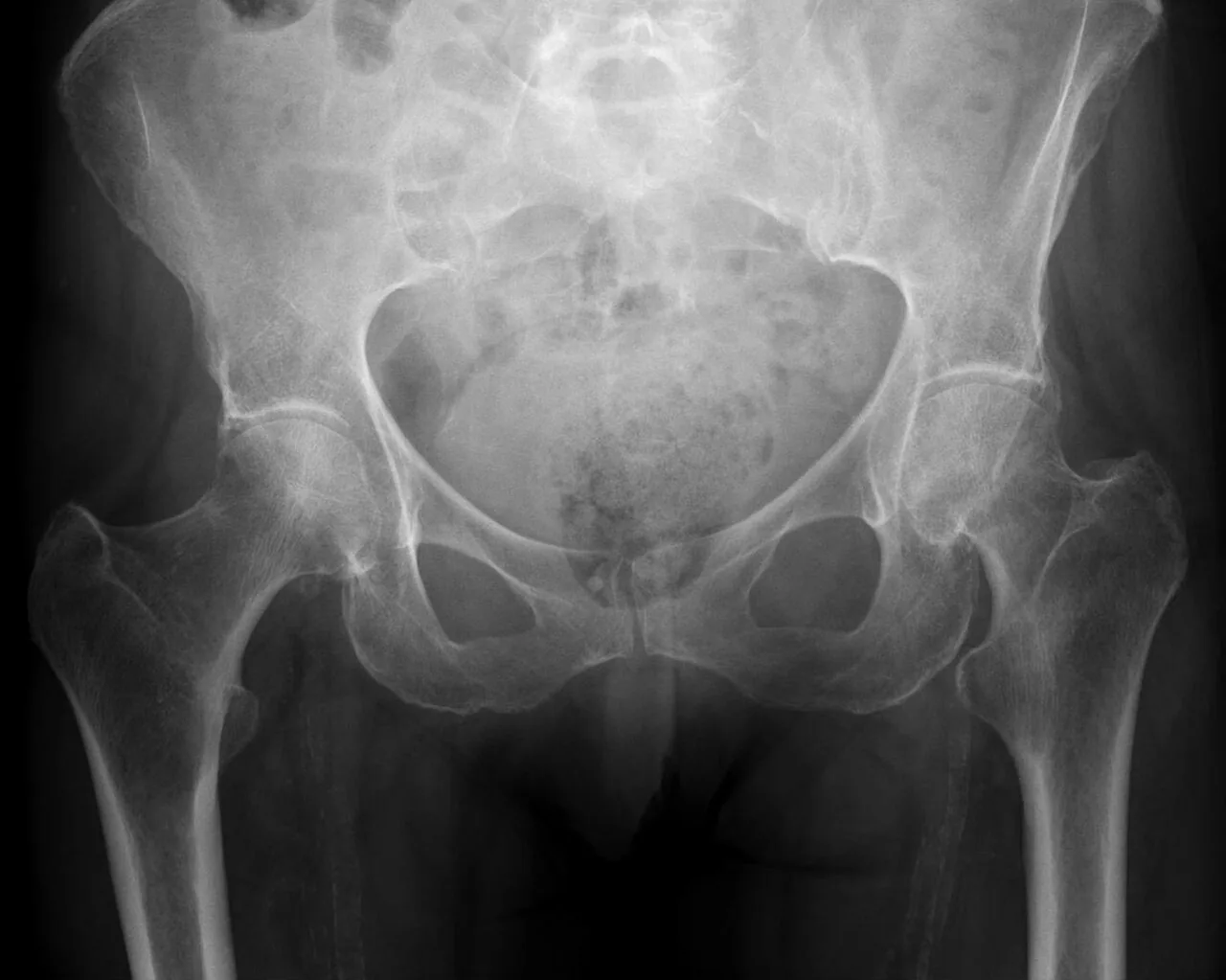 Lower limb radiograph for self-assessment