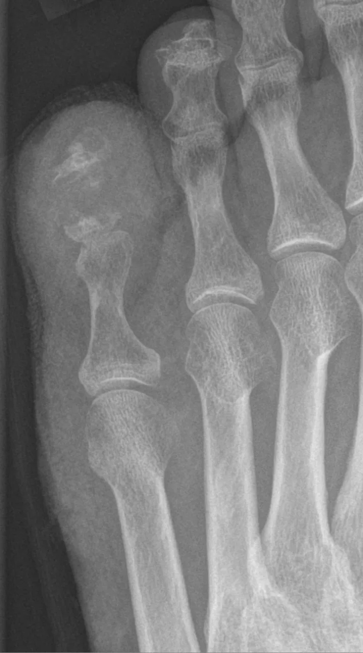 Bone & joint disease radiograph for self-assessment