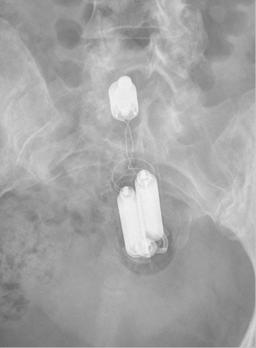 Abdomen radiograph for self-assessment