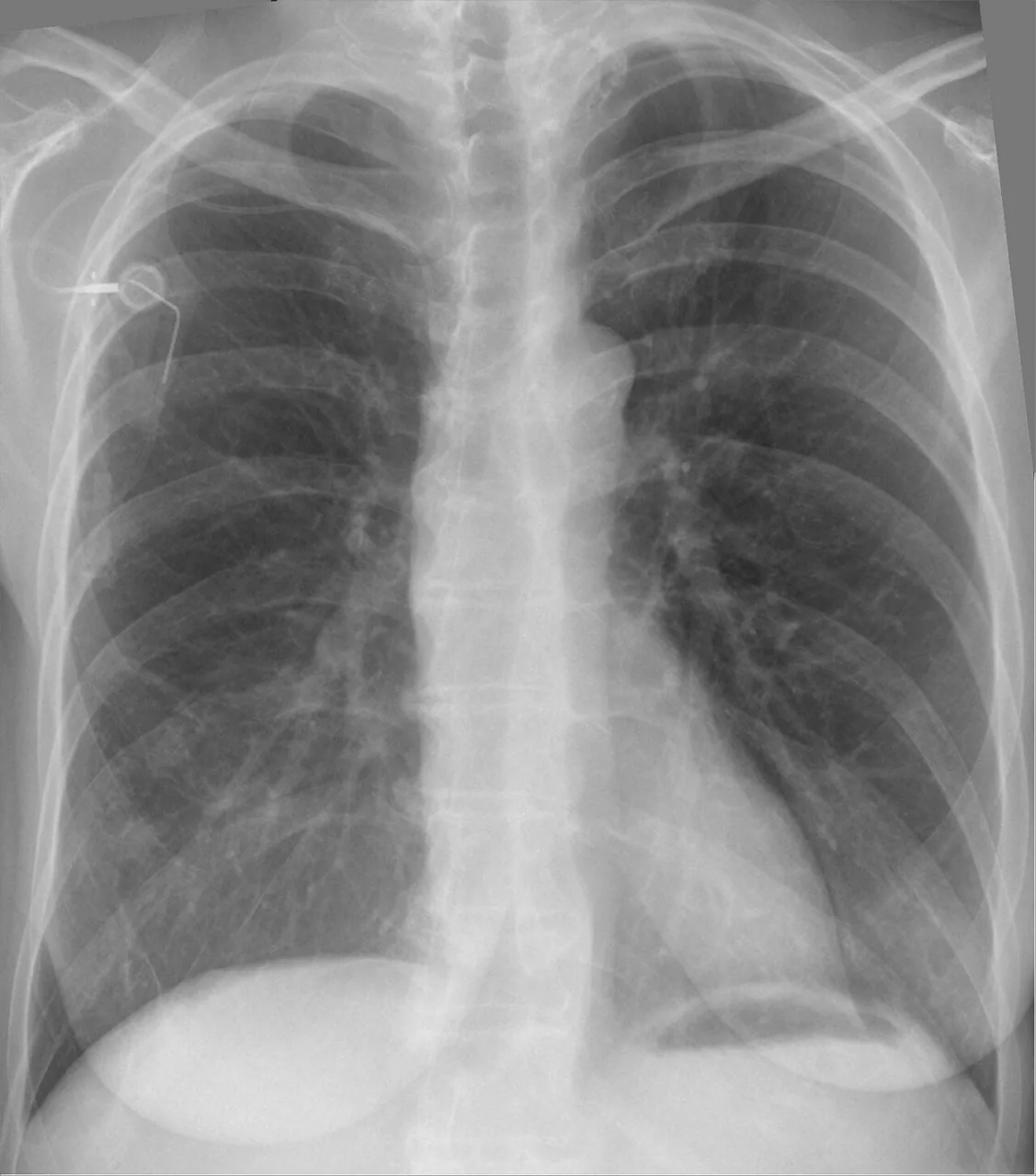 Lines & tubes radiograph for self-assessment